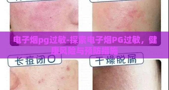 电子烟pg过敏-探索电子烟PG过敏，健康风险与预防措施